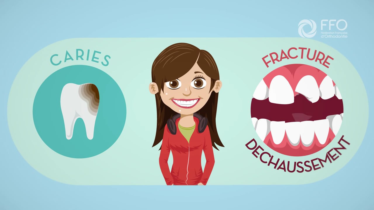 eclaircissement dentaire ermont eaubonne Conseils ; Vidéos Ermont Eaubonne Orthodontie