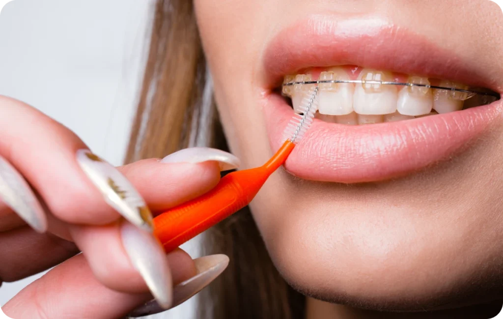 traitements chirurgicaux andilly dr papelard traitements chirurgicaux andilly dr papelard Appareil dentaire (métal ou céramique) Ermont Eaubonne Orthodontie