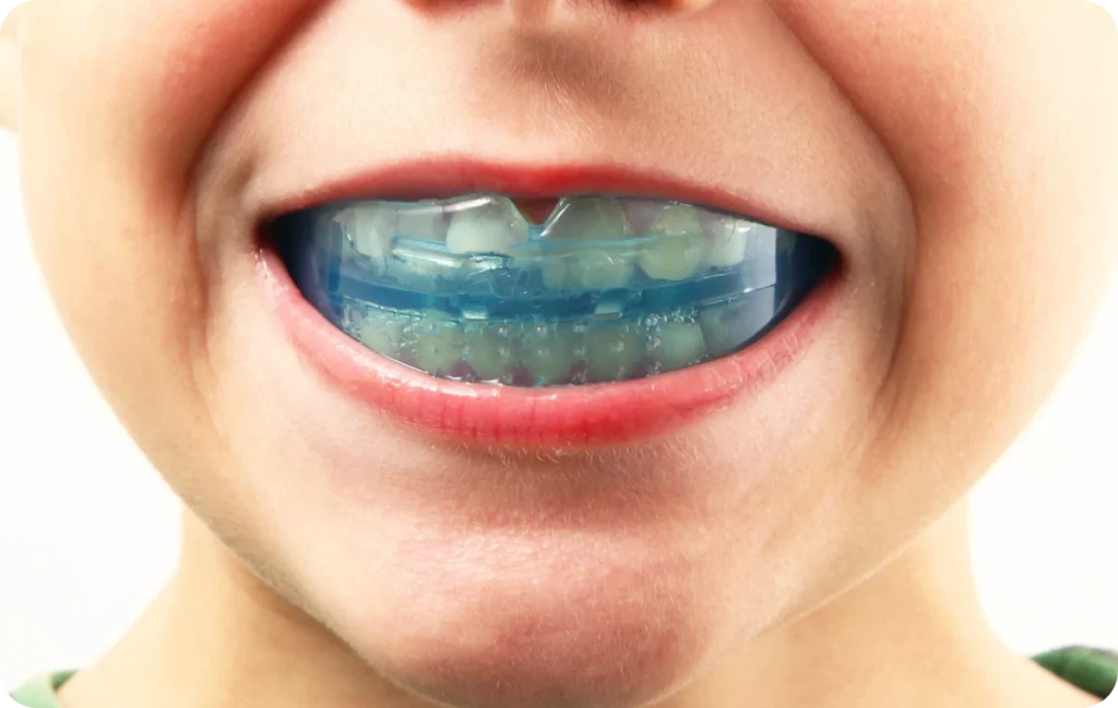traitements chirurgicaux enghien les bains traitements chirurgicaux enghien les bains Orthodontie fonctionnelle Ermont Eaubonne Orthodontie