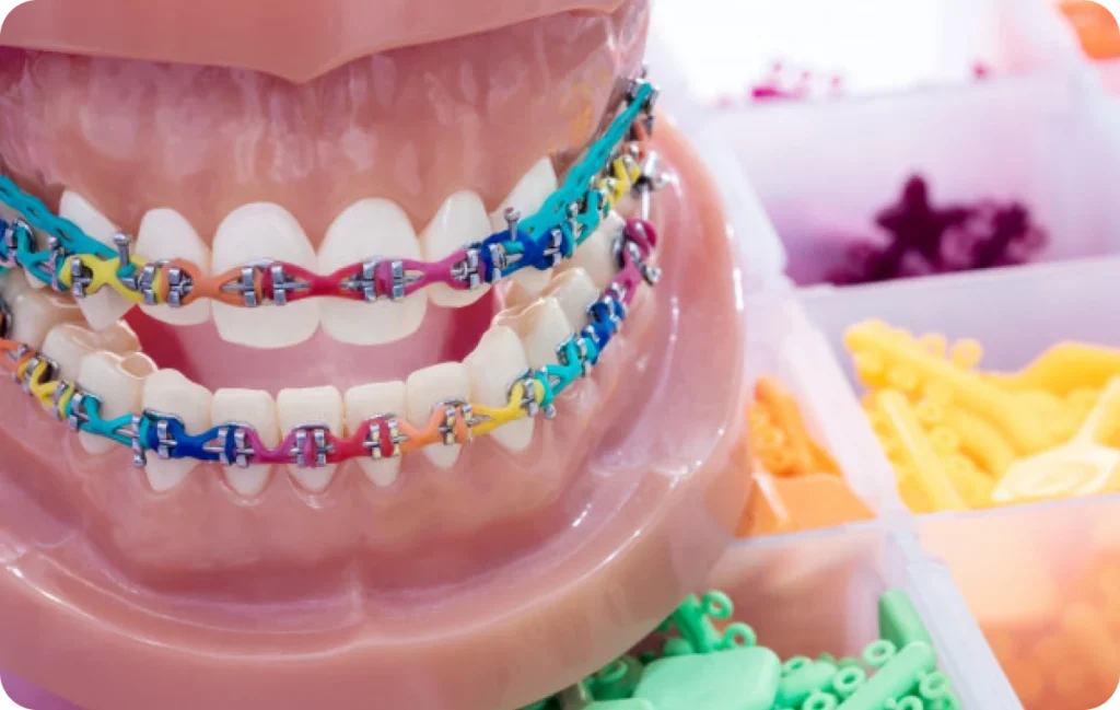 traitements chirurgicaux le plessis bouchard traitements chirurgicaux le plessis bouchard Appareil dentaire (métal ou céramique) Ermont Eaubonne Orthodontie