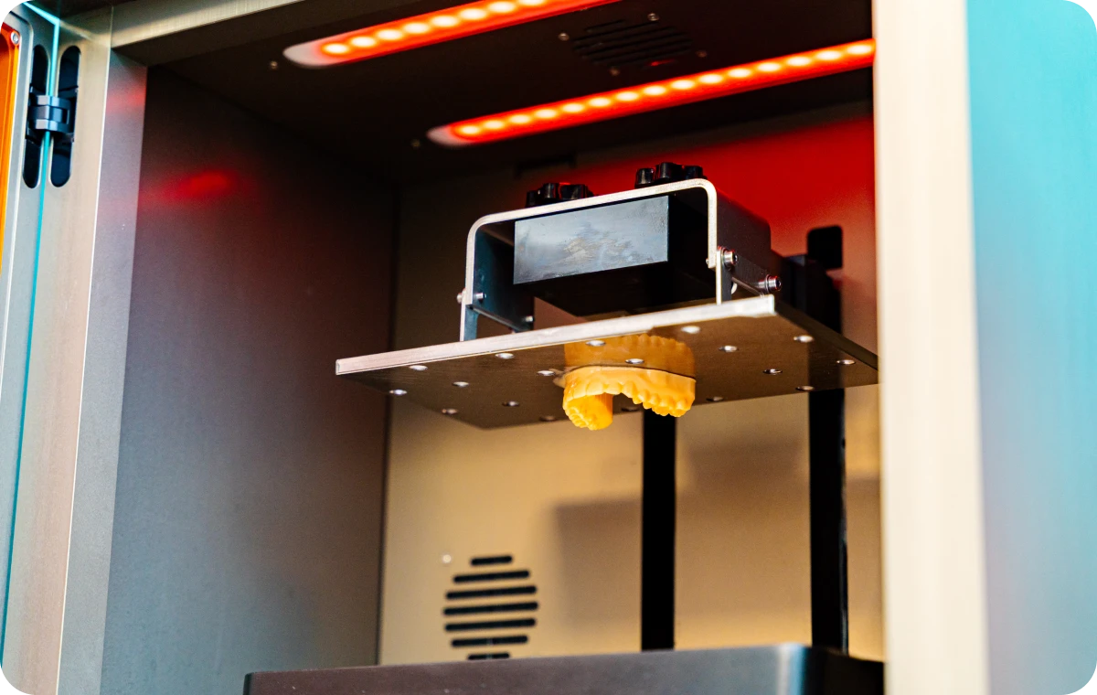 mxl Nos technologies Ermont Eaubonne Orthodontie