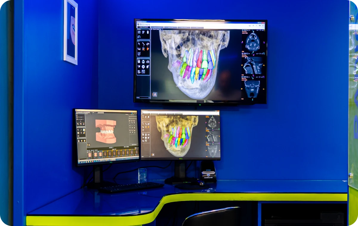 mxl Nos technologies Ermont Eaubonne Orthodontie