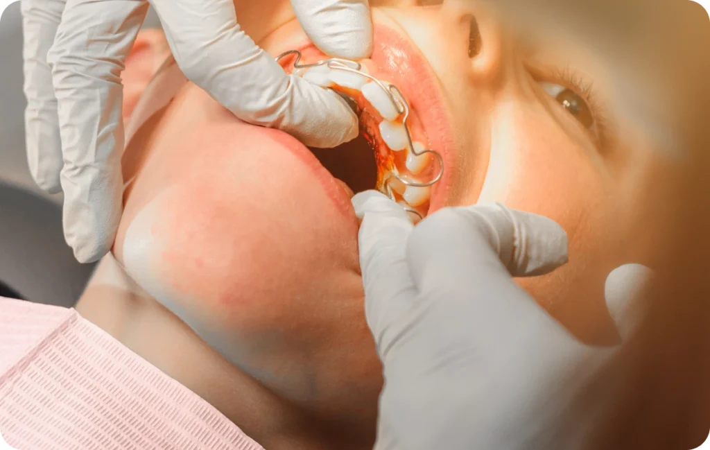 orthodontie fonctionnelle ermont eaubonne orthodontie fonctionnelle ermont eaubonne Orthodontiste Enghien-les-Bains Ermont Eaubonne Orthodontie